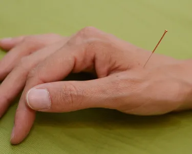 Akupunktur gegen Schwangerschaftsbeschwerden